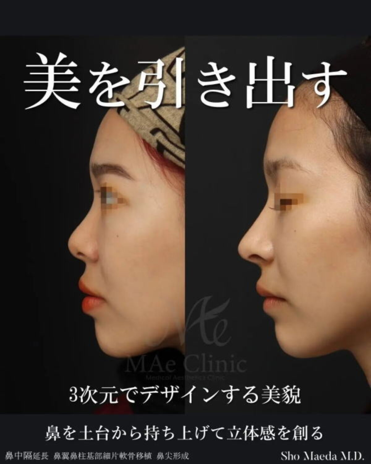 【裁断済み】外鼻形成術・鼻中隔矯正術 外鼻形成術・鼻中隔矯正術 | 増山敬祐, 上條 篤, 増山敬祐, 上條