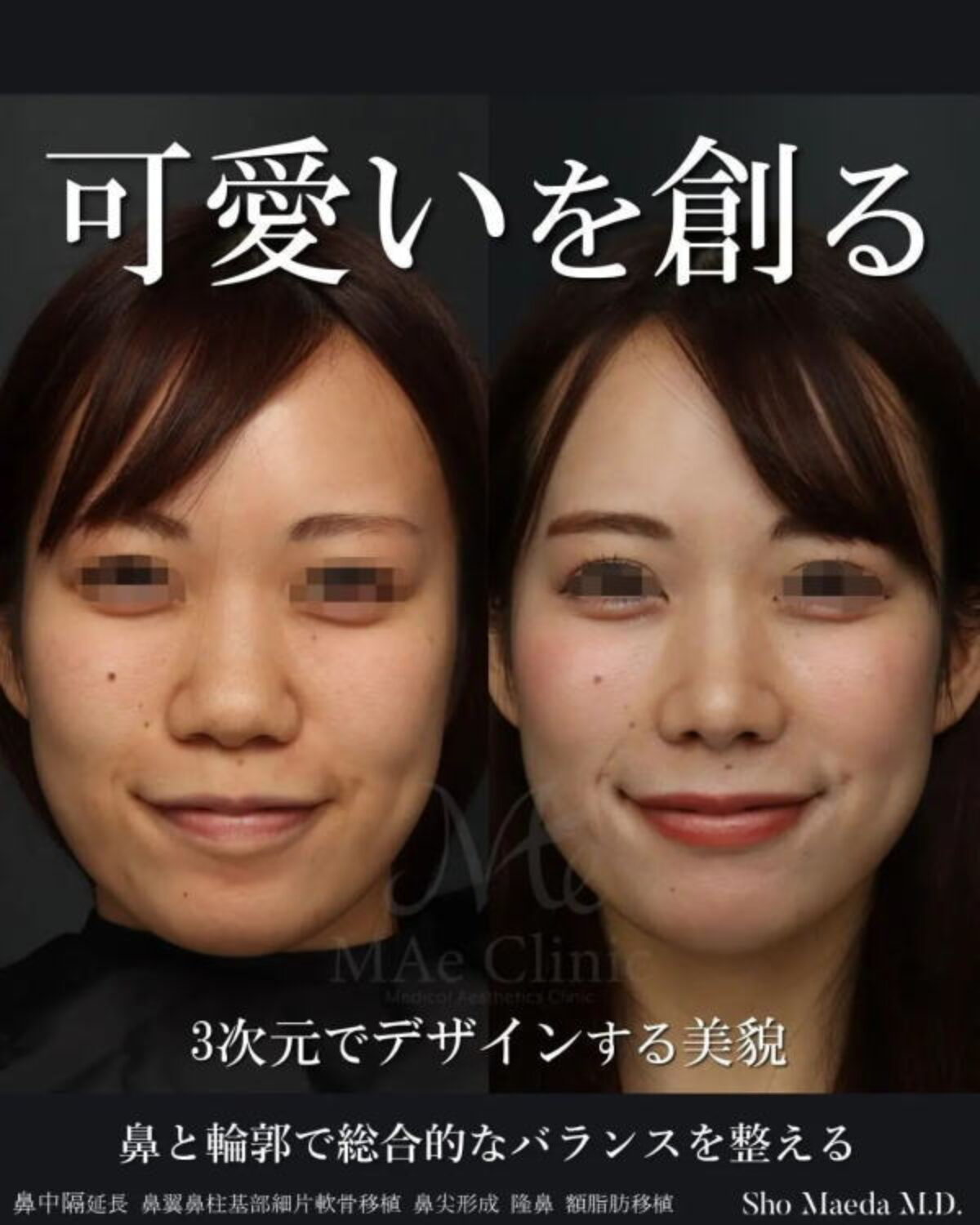 【裁断済】外鼻形成術・鼻中隔矯正術 外鼻形成術・鼻中隔矯正術 | 増山敬祐, 上條 篤, 増山敬祐, 上條