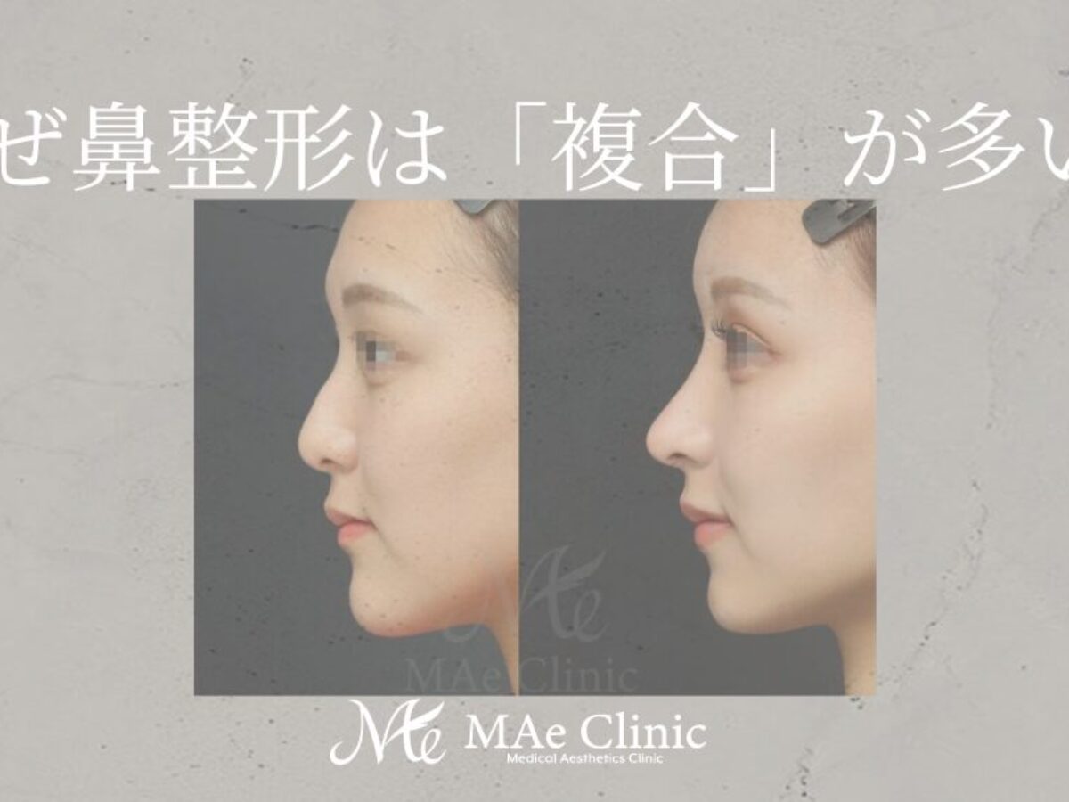 鼻形成術 = Aesthetic Rhinoplasty : 美容外科手術手技 鼻形成術 = Aesthetic Rhinoplasty : 美容外科手術手技