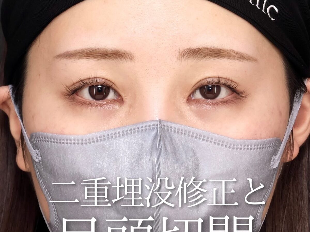 マルサン ヘドラ350 二重整形 マルサン ヘドラ350 二重整形 - メルカリ