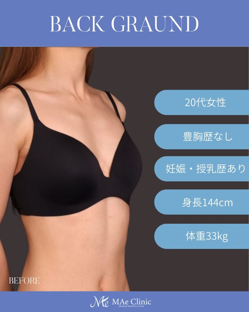 ハイブリッド豊胸症例　木下恵里沙医師