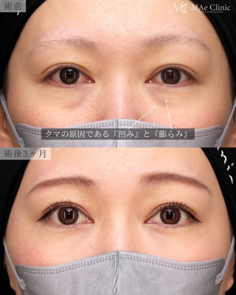 裏ハムラ 前之園健太医師症例