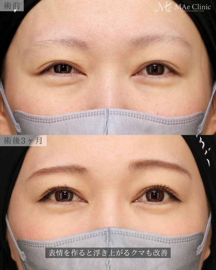 裏ハムラ 前之園健太医師症例