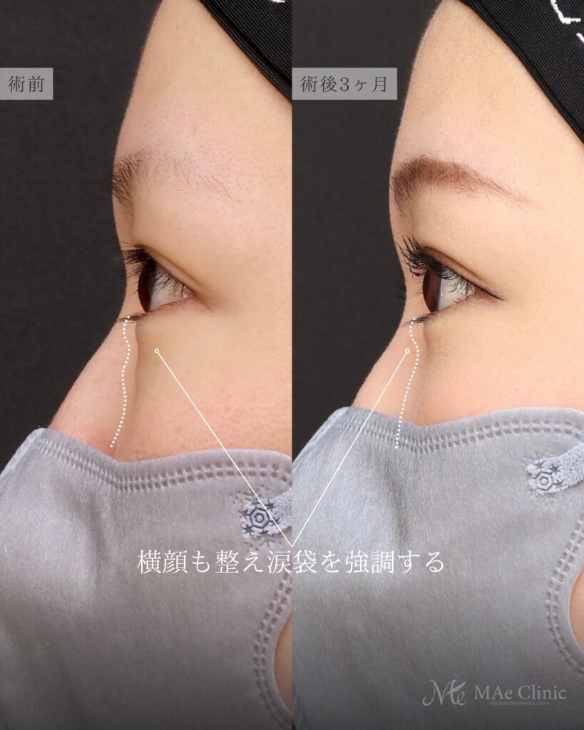 裏ハムラ 前之園健太医師症例