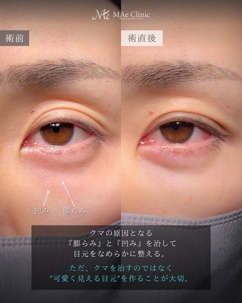 裏ハムラ 前之園健太医師症例