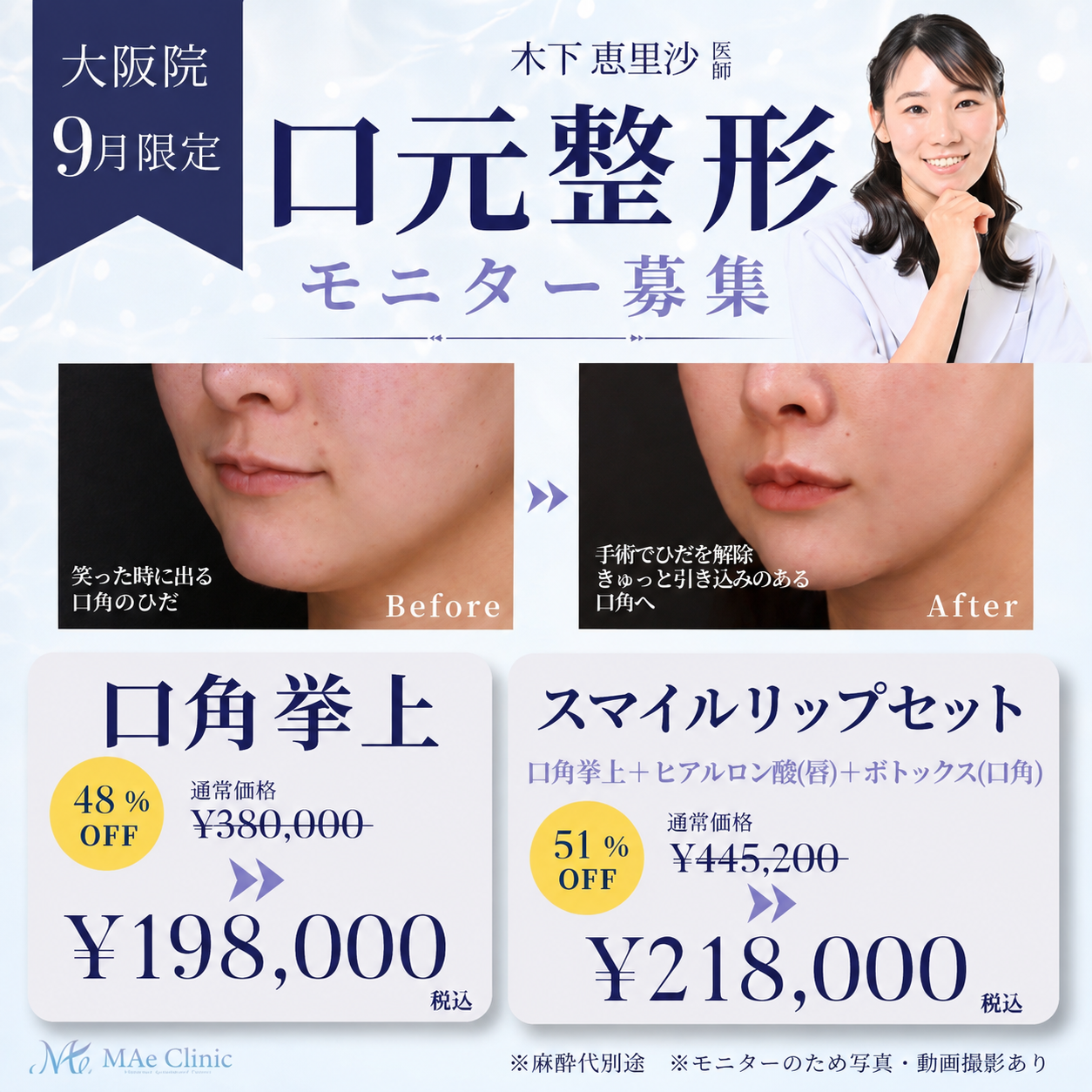 大阪院・9月限定】最大51%OFF！口元整形モニター募集｜木下恵里沙 医師