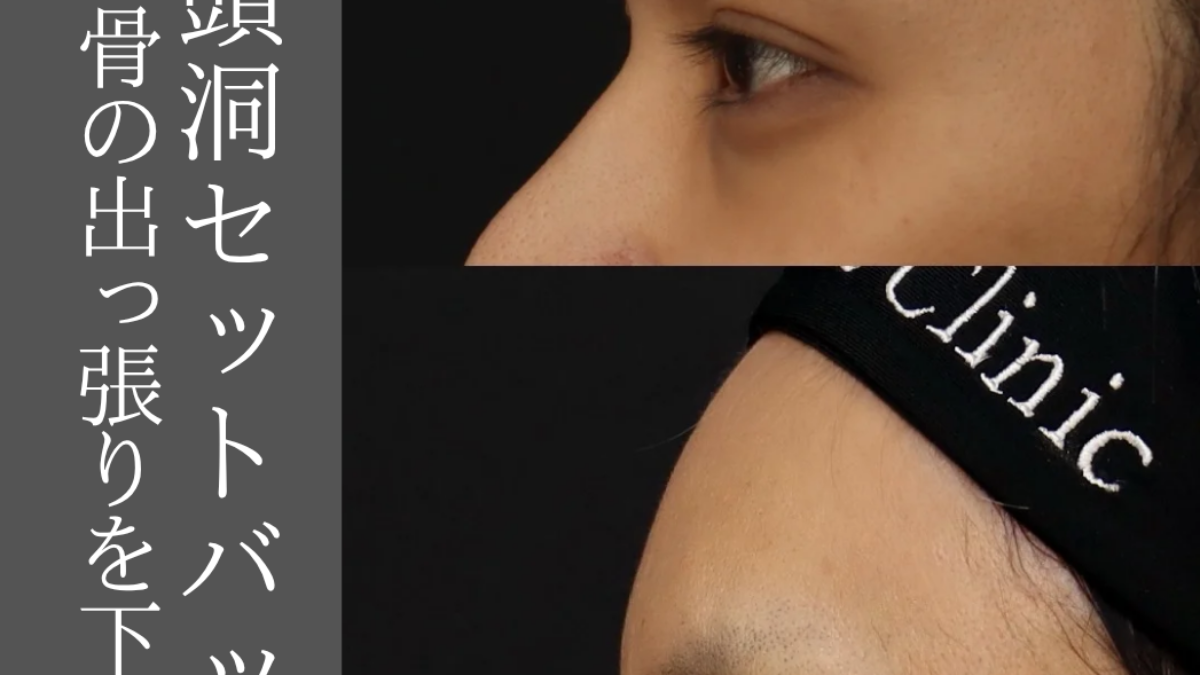 2026100929-1200x675.png
